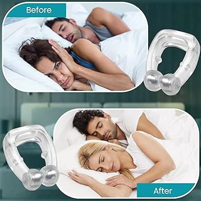 Anti Nose - নাক ডাকা বন্ধ করে